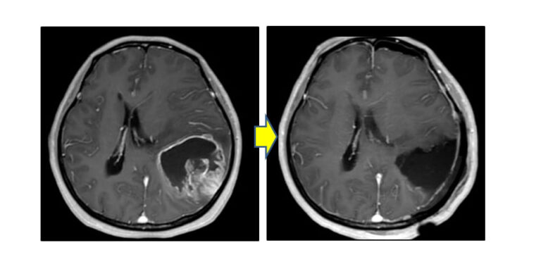 原因は何ですか?